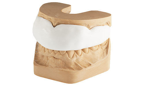 Protège-dents sur mesure