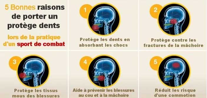 COMMENT MOULER SON PROTEGE DENTS VENUM ? 